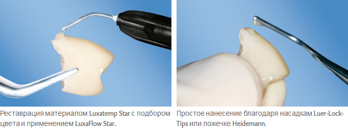 LuxaFlow_Star_ris.jpg LuxaFlow_Star_ris.jpg