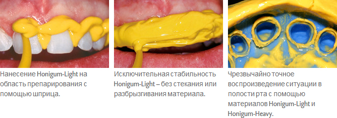 Honigum-Light_ris.jpg Honigum-Light_ris.jpg