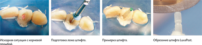 luxapostjpg.jpg luxapostjpg.jpg