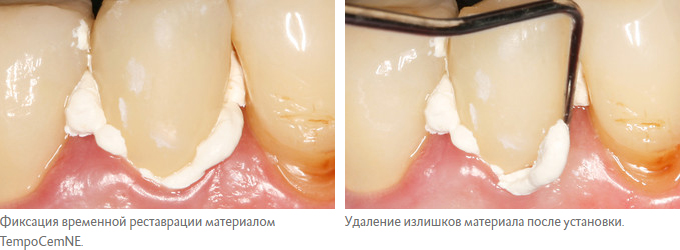 TempoCemNE.jpg