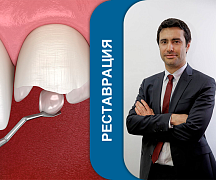 Особенности протезирования витальных зубов