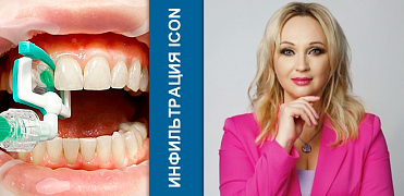 Инфильтрация. Искусство проникновения: чему нас учит ICON